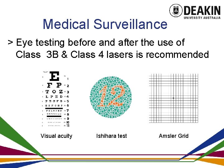 Medical Surveillance > Eye testing before and after the use of Class 3 B