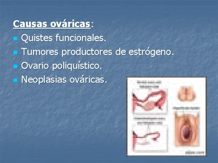 Causas ováricas: n Quistes funcionales. n Tumores productores de estrógeno. n Ovario poliquístico. n