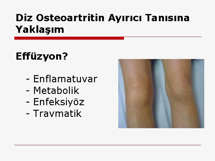 Diz Osteoartritin Ayırıcı Tanısına Yaklaşım Effüzyon? - Enflamatuvar Metabolik Enfeksiyöz Travmatik 