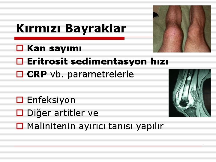 Kırmızı Bayraklar o Kan sayımı o Eritrosit sedimentasyon hızı o CRP vb. parametrelerle o