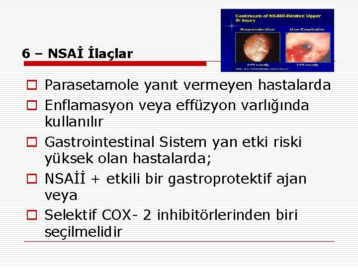 6 – NSAİ İlaçlar o Parasetamole yanıt vermeyen hastalarda o Enflamasyon veya effüzyon varlığında