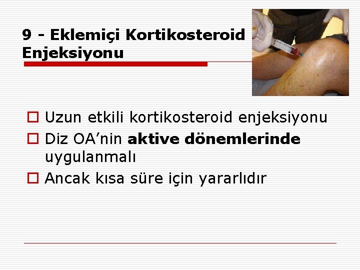 9 - Eklemiçi Kortikosteroid Enjeksiyonu o Uzun etkili kortikosteroid enjeksiyonu o Diz OA’nin aktive