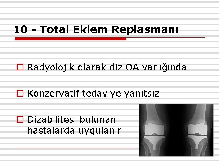 10 - Total Eklem Replasmanı o Radyolojik olarak diz OA varlığında o Konzervatif tedaviye