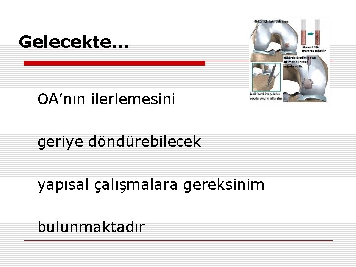 Gelecekte… OA’nın ilerlemesini geriye döndürebilecek yapısal çalışmalara gereksinim bulunmaktadır 