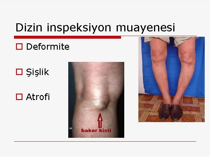 Dizin inspeksiyon muayenesi o Deformite o Şişlik o Atrofi 