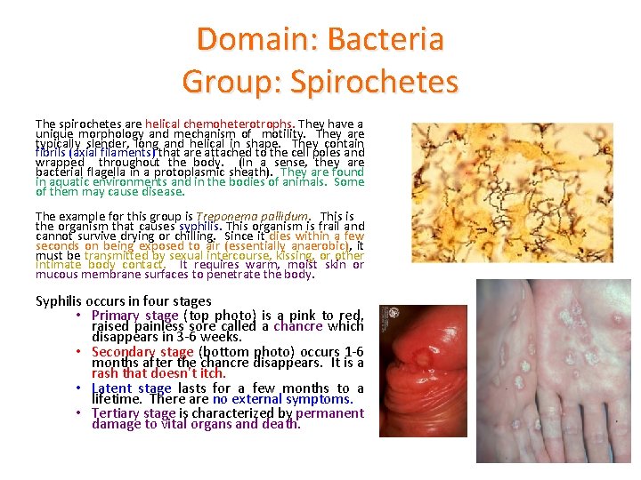 Domain: Bacteria Group: Spirochetes The spirochetes are helical chemoheterotrophs. They have a unique morphology