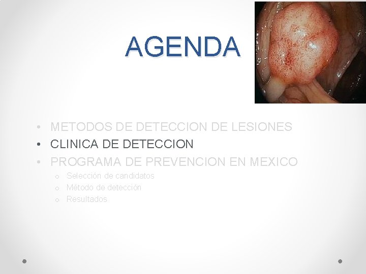 AGENDA • METODOS DE DETECCION DE LESIONES • CLINICA DE DETECCION • PROGRAMA DE