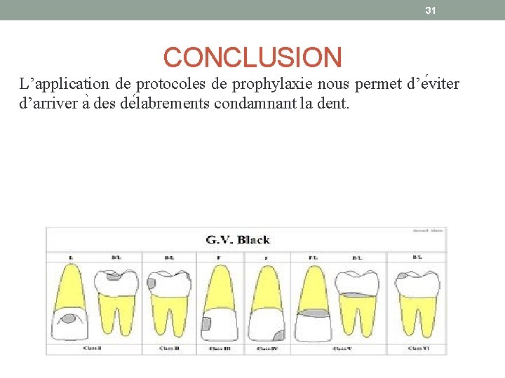 31 CONCLUSION L’application de protocoles de prophylaxie nous permet d’e viter d’arriver a des