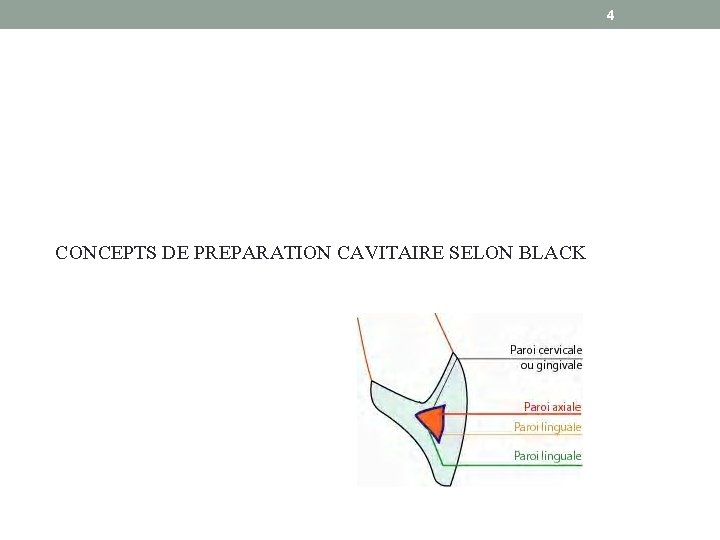 4 CONCEPTS DE PREPARATION CAVITAIRE SELON BLACK 