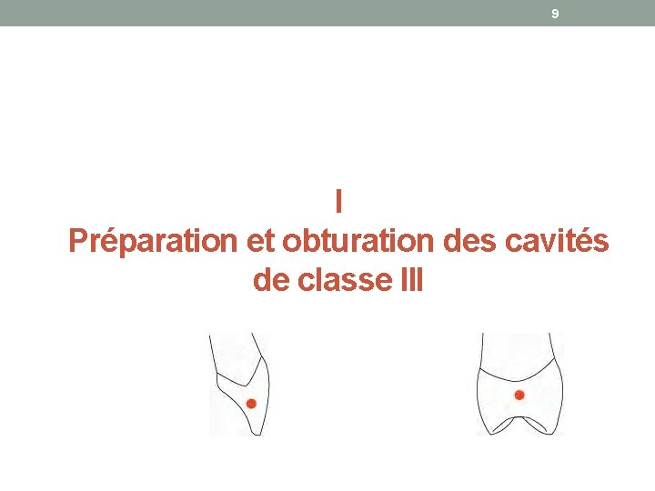9 I Préparation et obturation des cavités de classe III 
