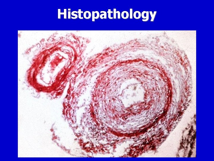 Histopathology 
