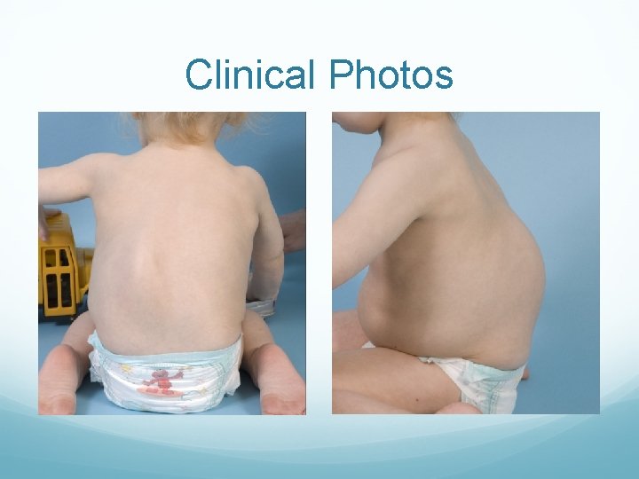 Clinical Photos 