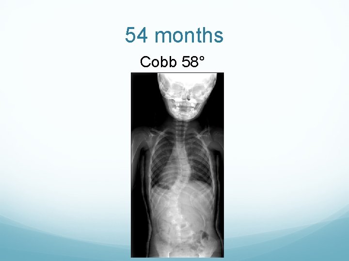 54 months Cobb 58° 