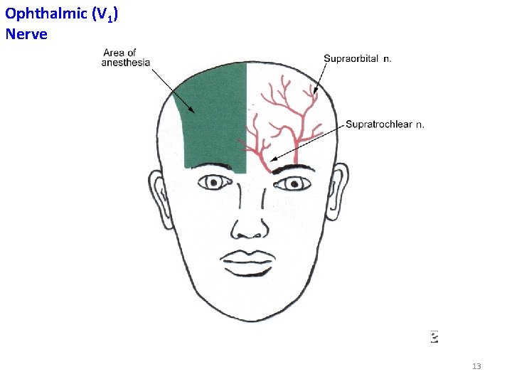 Ophthalmic (V 1) Nerve 13 