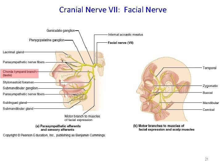 Cranial Nerve VII: Facial Nerve 21 