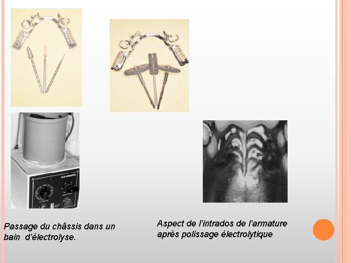 Passage du châssis dans un bain d’électrolyse. Aspect de l’intrados de l’armature après polissage