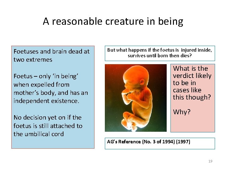 A reasonable creature in being Foetuses and brain dead at two extremes Foetus –