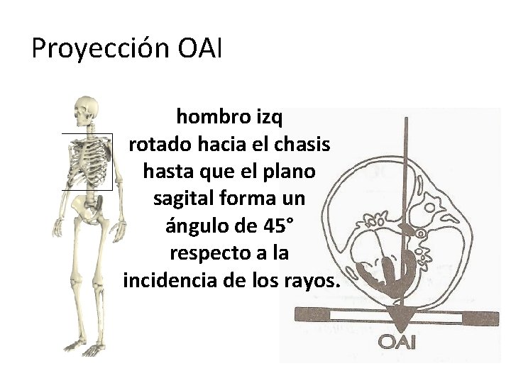 Proyección OAI hombro izq rotado hacia el chasis hasta que el plano sagital forma Proyección OAI hombro izq rotado hacia el chasis hasta que el plano sagital forma
