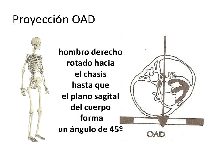 Proyección OAD hombro derecho rotado hacia el chasis hasta que el plano sagital del Proyección OAD hombro derecho rotado hacia el chasis hasta que el plano sagital del