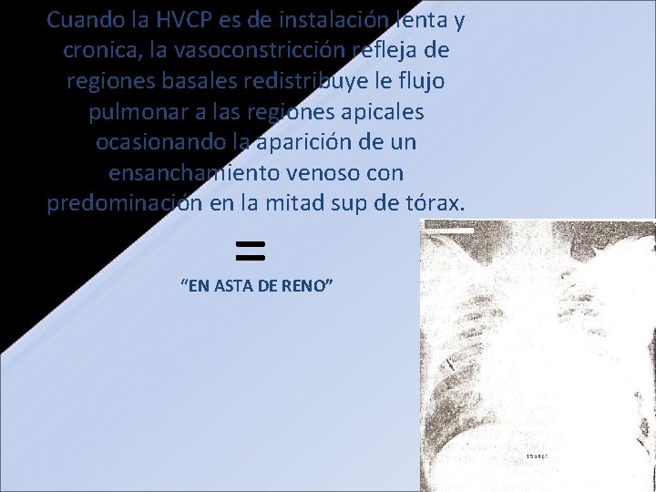 Cuando la HVCP es de instalación lenta y cronica, la vasoconstricción refleja de regiones Cuando la HVCP es de instalación lenta y cronica, la vasoconstricción refleja de regiones