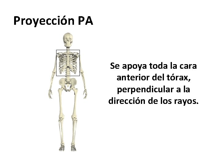 Proyección PA Se apoya toda la cara anterior del tórax, perpendicular a la dirección Proyección PA Se apoya toda la cara anterior del tórax, perpendicular a la dirección