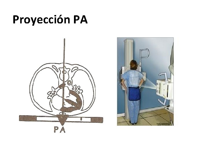 Proyección PA Proyección PA