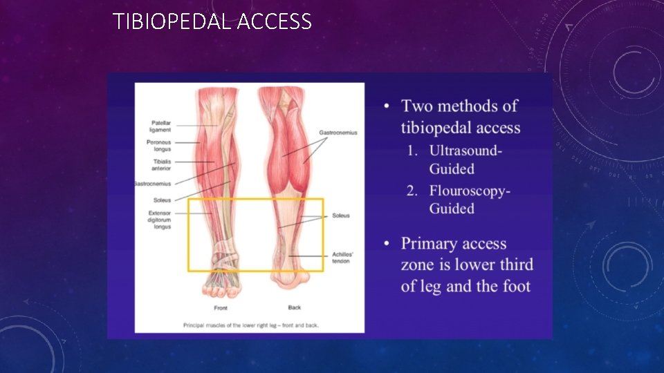 TIBIOPEDAL ACCESS 