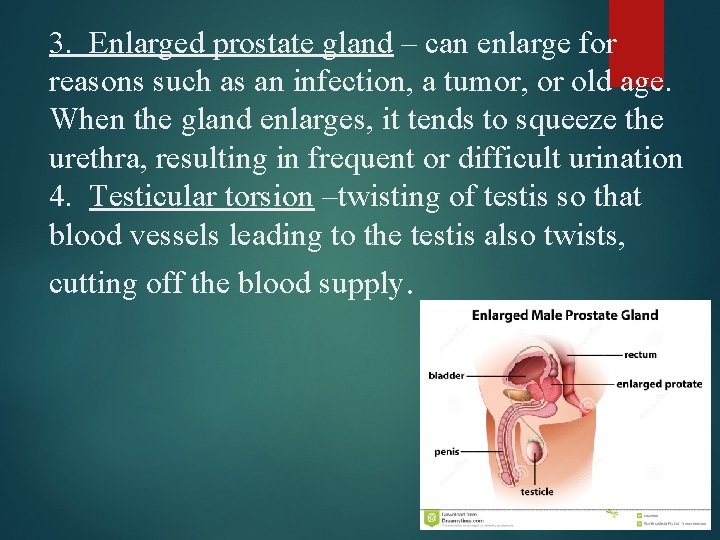 3. Enlarged prostate gland – can enlarge for reasons such as an infection, a