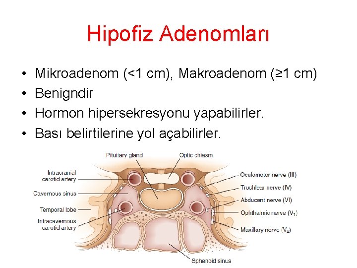 Hipofiz Adenomları • • Mikroadenom (<1 cm), Makroadenom (≥ 1 cm) Benigndir Hormon hipersekresyonu Hipofiz Adenomları • • Mikroadenom (<1 cm), Makroadenom (≥ 1 cm) Benigndir Hormon hipersekresyonu