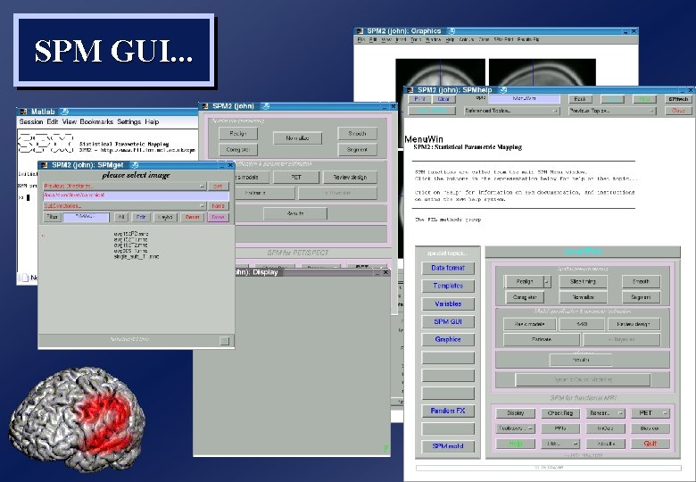 SPM GUI. . . 