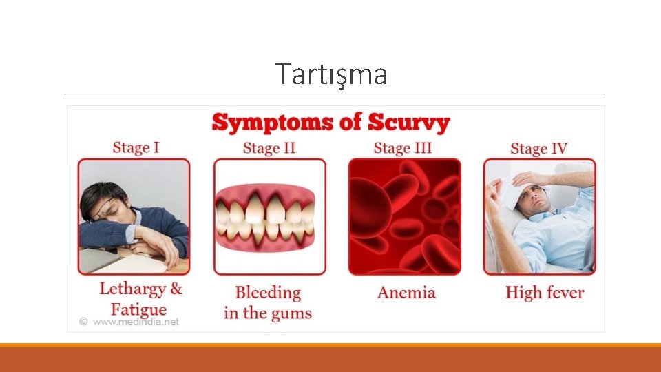 Tartışma 