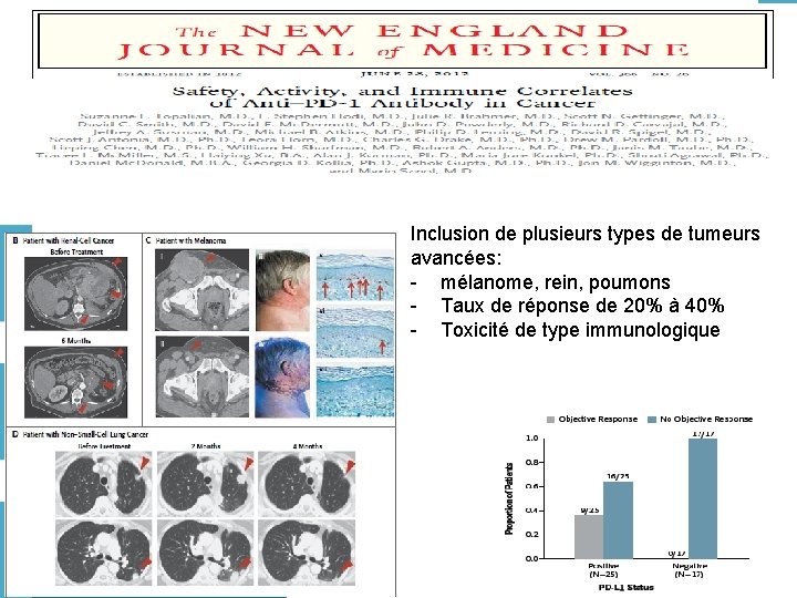 Immunothérapies Inclusion de plusieurs types de tumeurs avancées: - mélanome, rein, poumons - Taux
