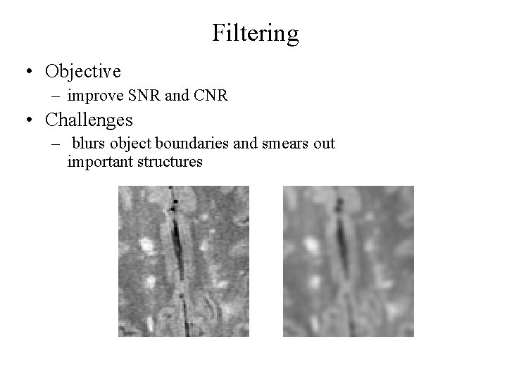 Filtering • Objective – improve SNR and CNR • Challenges – blurs object boundaries