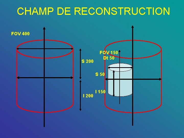 CHAMP DE RECONSTRUCTION FOV 400 S 200 FOV 150 Dt 50 S 50 I