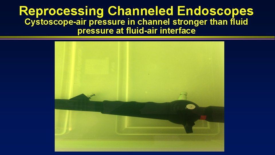 Reprocessing Channeled Endoscopes Cystoscope-air pressure in channel stronger than fluid pressure at fluid-air interface