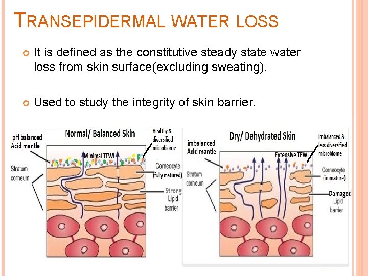 TRANSEPIDERMAL WATER LOSS It is defined as the constitutive steady state water loss from TRANSEPIDERMAL WATER LOSS It is defined as the constitutive steady state water loss from