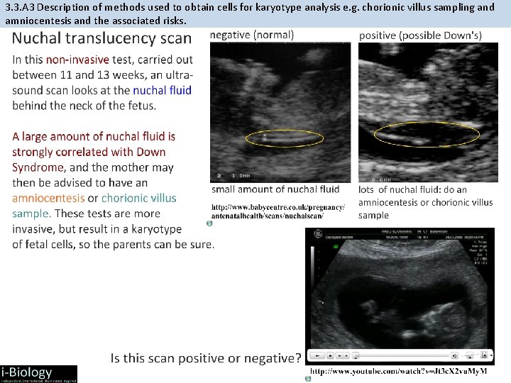 3. 3. A 3 Description of methods used to obtain cells for karyotype analysis