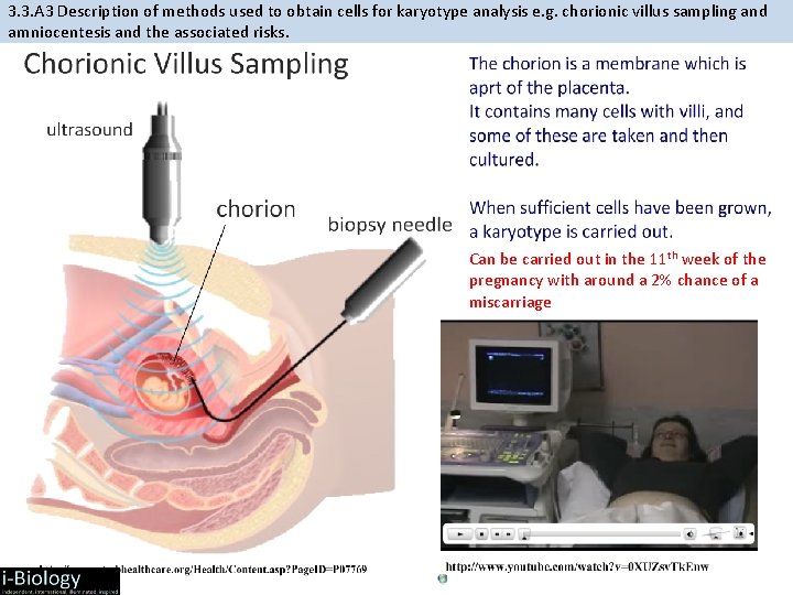 3. 3. A 3 Description of methods used to obtain cells for karyotype analysis