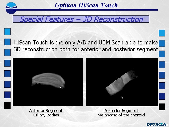 Optikon Hi. Scan Touch Special Features – 3 D Reconstruction Hi. Scan Touch is