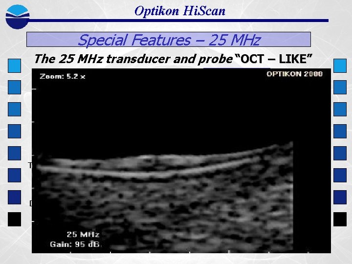 Optikon Hi. Scan Special Features – 25 MHz The 25 MHz transducer and probe