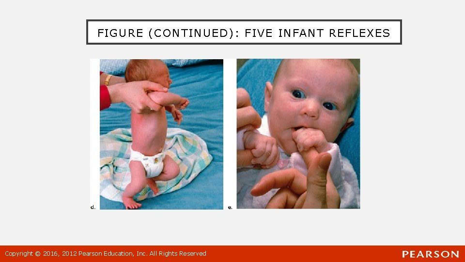 FIGURE (CONTINUED): FIVE INFANT REFLEXES Copyright © 2016, 2012 Pearson Education, Inc. All Rights