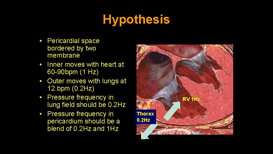 Hypothesis • Pericardial space bordered by two membrane • Inner moves with heart at Hypothesis • Pericardial space bordered by two membrane • Inner moves with heart at