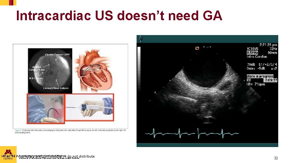 Intracardiac US doesn’t need GA A collaboration among the University of Minnesota, Proprietary and Intracardiac US doesn’t need GA A collaboration among the University of Minnesota, Proprietary and