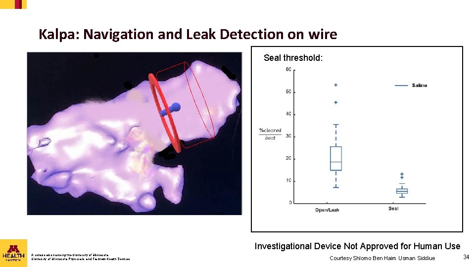 Kalpa: Navigation and Leak Detection on wire Seal threshold: Investigational Device Not Approved for Kalpa: Navigation and Leak Detection on wire Seal threshold: Investigational Device Not Approved for
