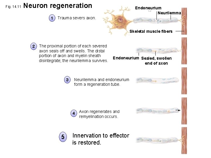 Fig. 14. 11 Neuron regeneration 1 Endoneurium Neurilemma Trauma severs axon. Skeletal muscle fibers