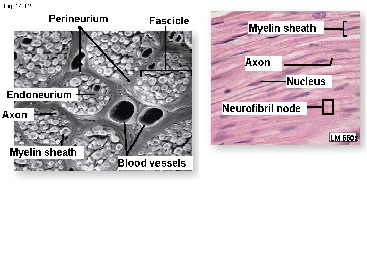 Fig. 14. 12 Perineurium Fascicle Myelin sheath Axon Nucleus Endoneurium Neurofibril node Axon LM