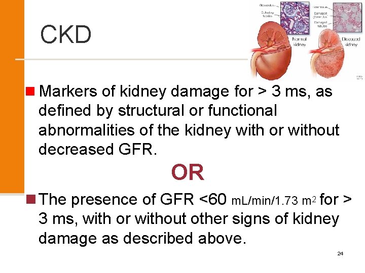 CKD n Markers of kidney damage for > 3 ms, as defined by structural