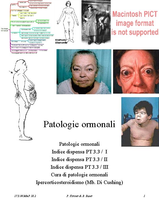 Patologie ormonali Indice dispensa PT 3. 3 / III Cura di patologie ormonali Ipercorticosteroidismo
