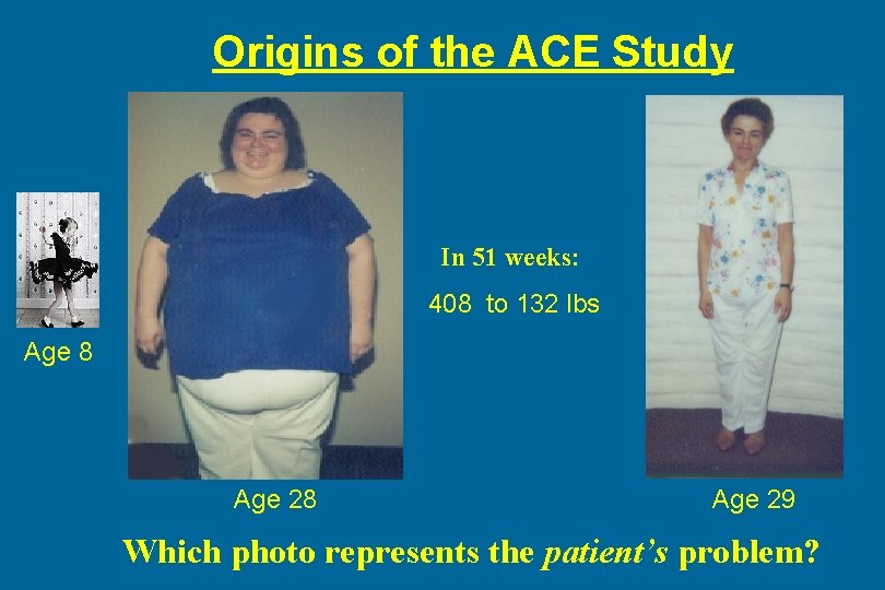 Origins of the ACE Study In 51 weeks: 408 to 132 lbs Age 8