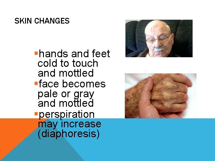 SKIN CHANGES §hands and feet cold to touch and mottled §face becomes pale or SKIN CHANGES §hands and feet cold to touch and mottled §face becomes pale or